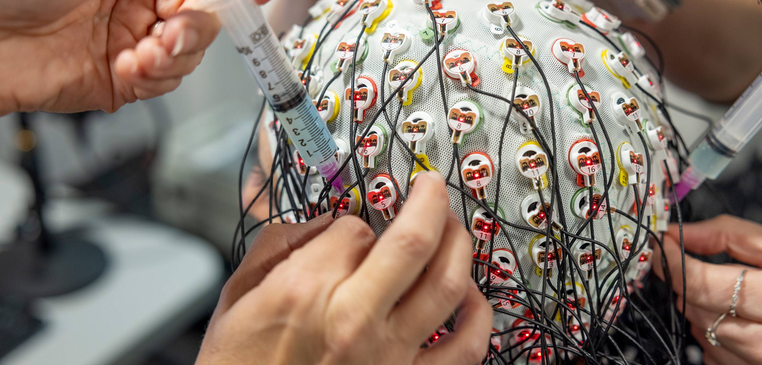Aging Brain Cohort Image 